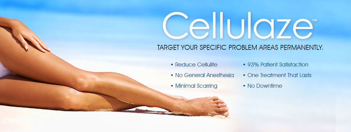 Cellulaze™ Cellulite Treatment