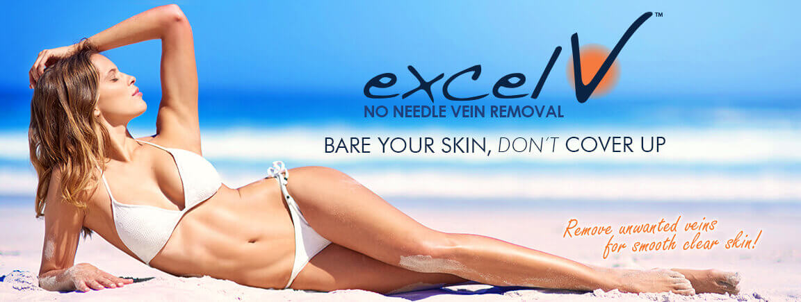 Excel V™ Laser Vein Treatment